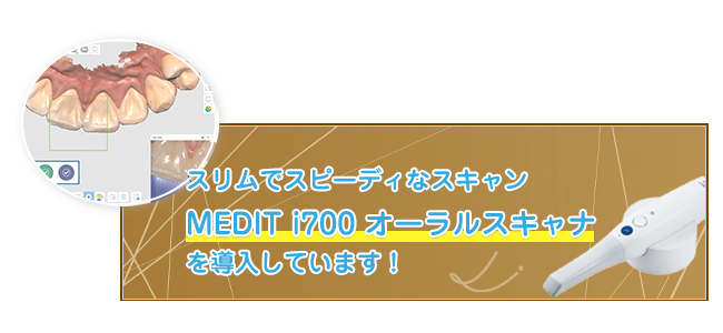 スリムでスピーディなスキャンMEDIT i700 オーラルスキャナを導入しています！