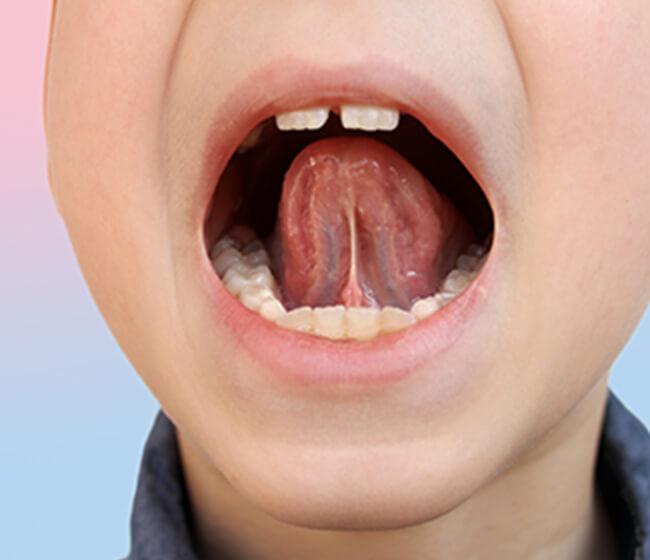 舌で前歯を押すイメージ