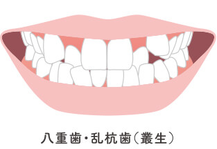 全体矯正に適した症状イメージ