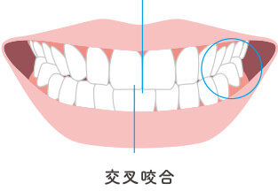 全体矯正に適した症状イメージ