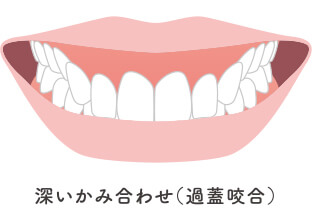 全体矯正に適した症状イメージ