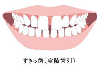 全体矯正に適した症状イメージ