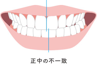 全体矯正に適した症状イメージ